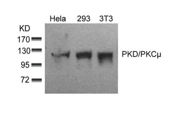 PRKD1 (Ab-910) Antibody (PACO21381)