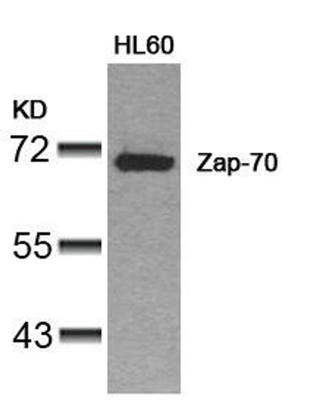 ZAP70 (Ab-319) Antibody (PACO22935)