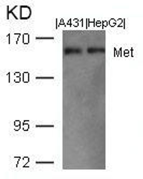 MET (Ab-1003) Antibody (PACO23003)
