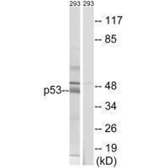 TP53 (Ab-378) Antibody (PACO23058)