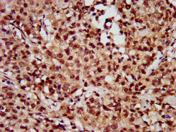 HIST1H3A (Ab-56) Antibody (PACO57645)