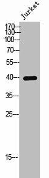 Phospho-CCR5 (S336) Antibody (PACO02460)