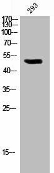 Phospho-PDCD4 (S457) Antibody (PACO02785)