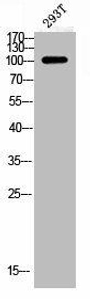 Phospho-GRIN1 (S896) Antibody (PACO02794)