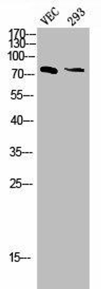 Phospho-MAPT (T205) Antibody (PACO02890)