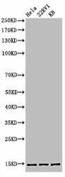 Acetyl-Histone H3 (K27) Antibody (PACO06049)