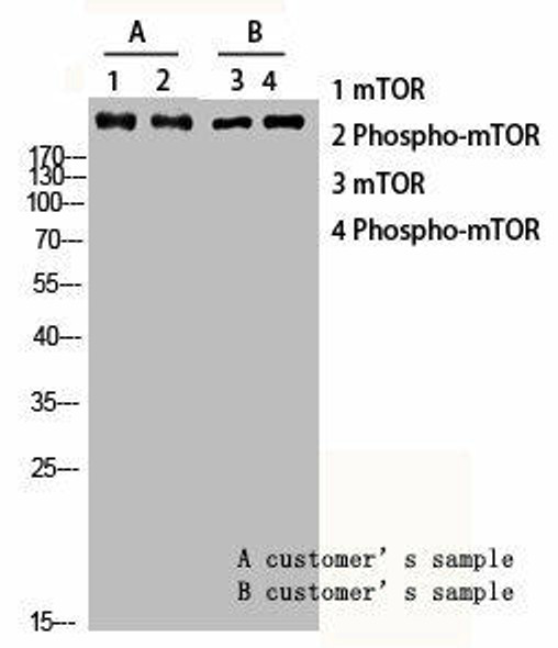 Phospho-MTOR (S2448) Antibody (PACO06142)
