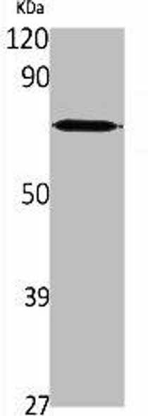 SLC25A12 Antibody (PACO06260)