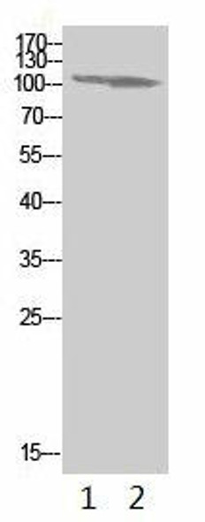 Acetyl-PARP1 (K521) Antibody (PACO07430)