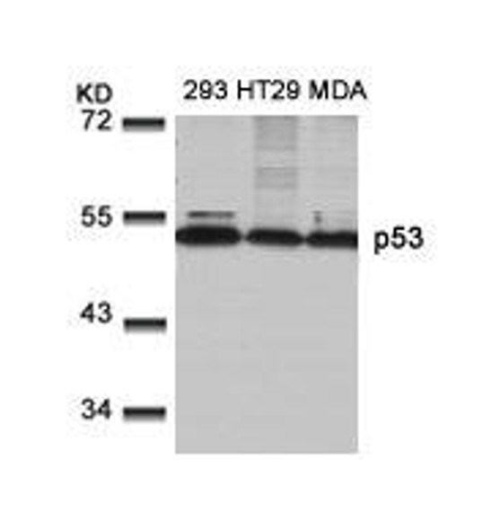 TP53 (Ab-9) Antibody (PACO21358)