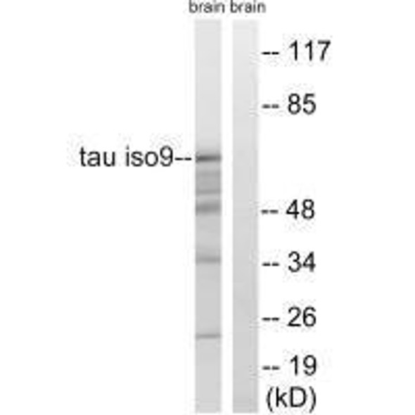 MAPT (Ab-717/400) Antibody (PACO21596)