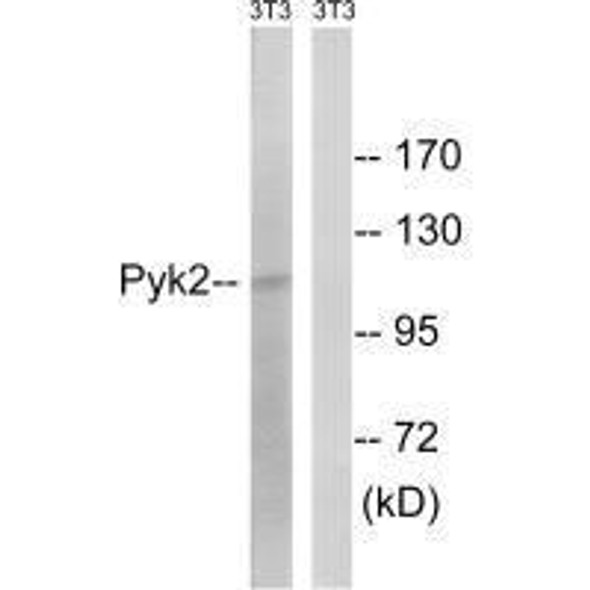 PTK2B (Ab-579) Antibody (PACO23073)