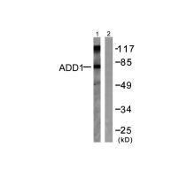 ADD1 (Ab-726) Antibody (PACO23604)