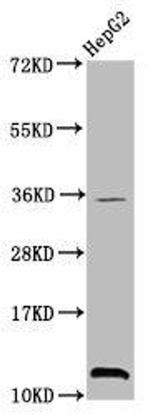 Tri-methyl-HIST1H4A (K20) Antibody (PACO58637)