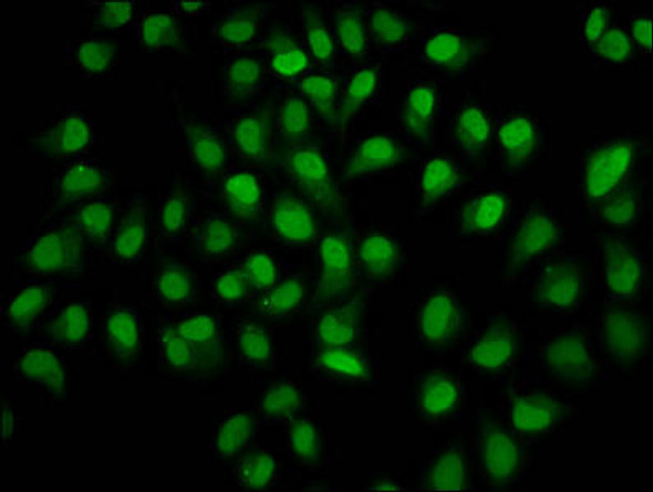 HIST1H4A (Ab-12) Antibody (PACO59632)