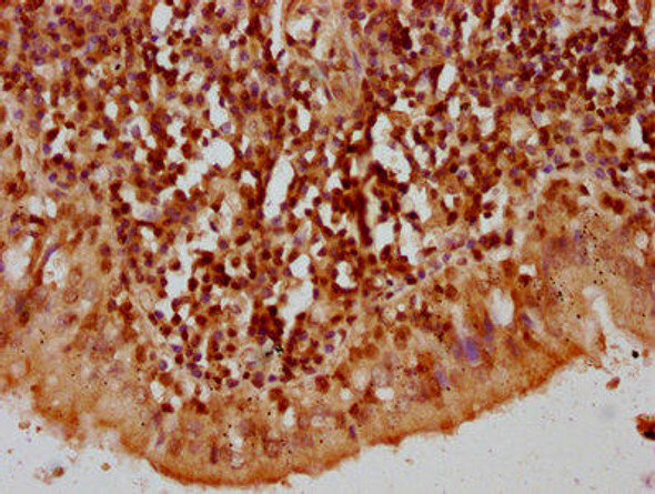 HIST1H2AG (Ab-119) Antibody (PACO60630)