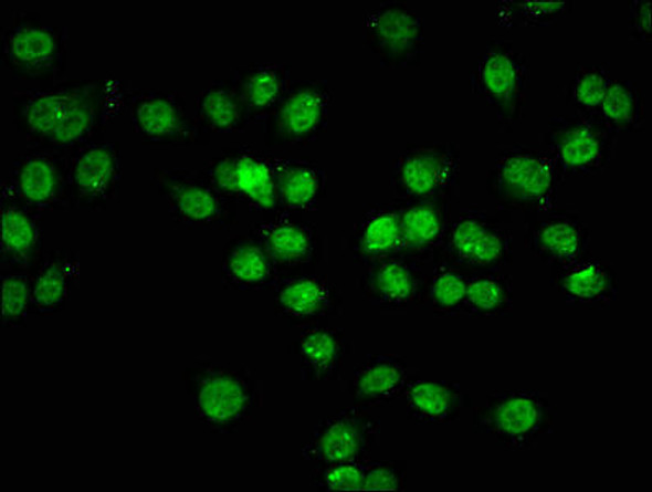 Acetyl-HIST1H1C (K74) Antibody (PACO61283)