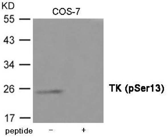 Phospho-TK1 (Ser13) Antibody (PACO23947)