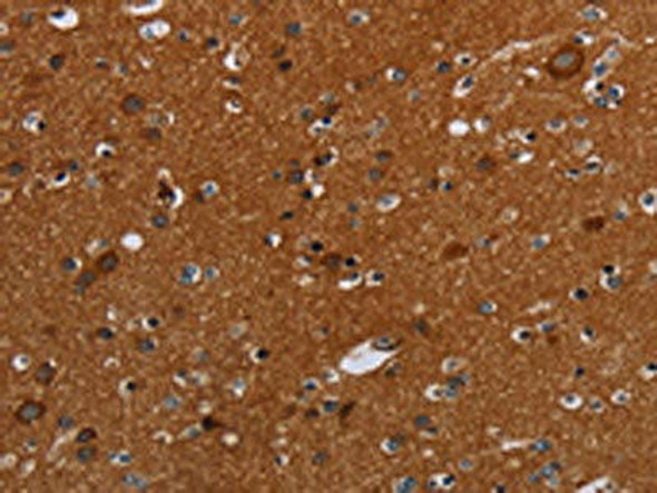 SLC22A12 Antibody (PACO20134)