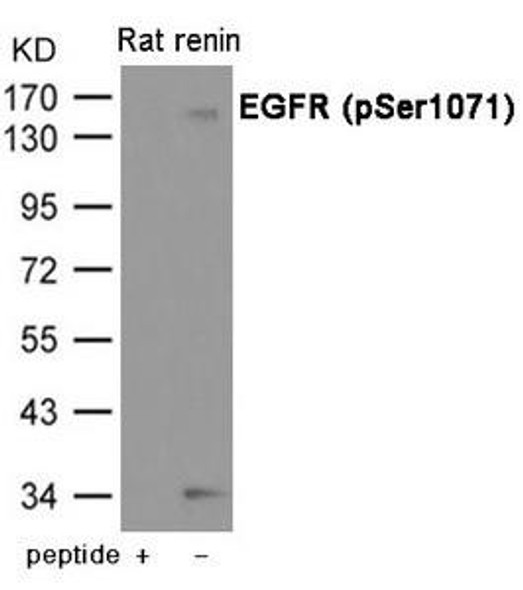 Phospho-EGFR (Ser1071) Antibody (PACO23992)