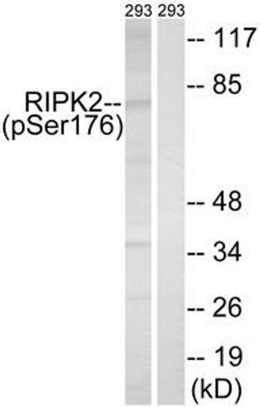 Phospho-RIPK2 (Ser176) Antibody (PACO24421)