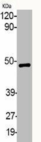 Phospho-MAP2K1/MAP2K2 (S218/222) Antibody (PACO06140)