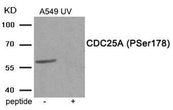 Phospho-CDC25A (Ser178) Antibody (PACO24036)
