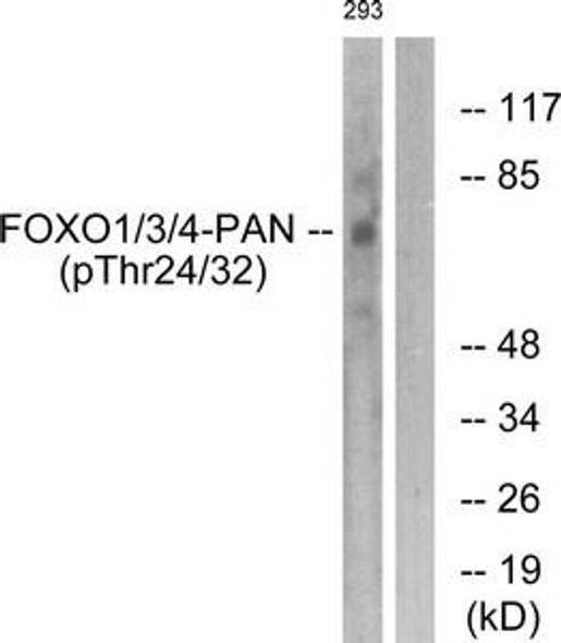 Phospho-FOXO1/FOXO3/FOXO4 (Thr24/32) Antibody (PACO24086)