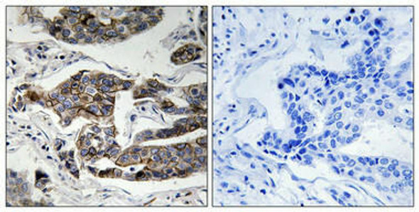 Phospho-CCDC88A (Ser1417) Antibody (PACO24154)