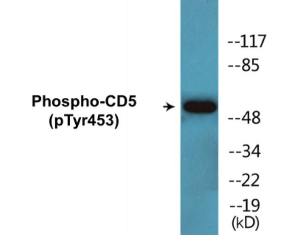 CD5 (Phospho-Tyr453) Colorimetric Cell-Based ELISA Kit
