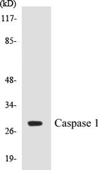 Caspase 1 Colorimetric Cell-Based ELISA Kit (CBCAB00062)