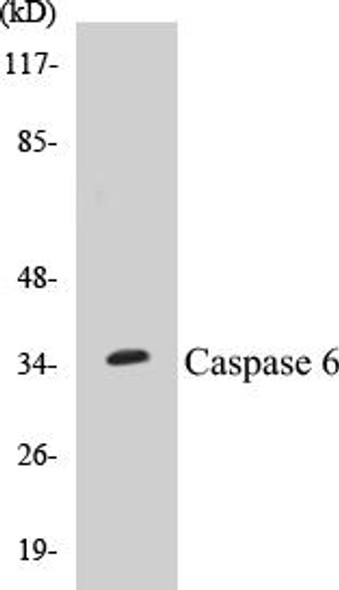 Caspase 6 Colorimetric Cell-Based ELISA Kit (CBCAB00160)