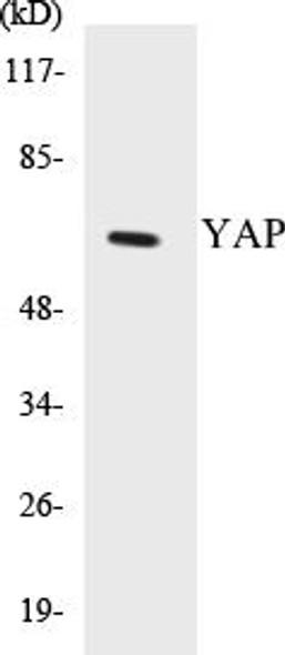 YAP Colorimetric Cell-Based ELISA Kit (CBCAB00209)