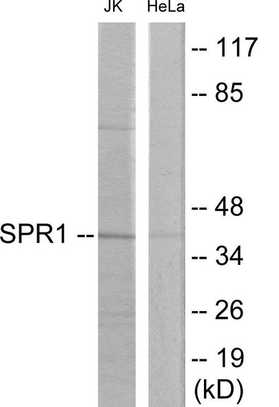 OGR-1 Colorimetric Cell-Based ELISA (CBCAB00216)