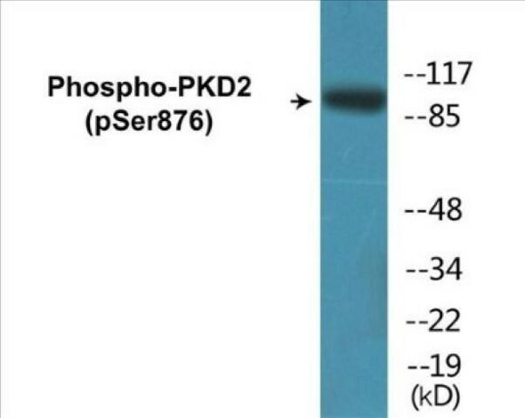 PKD2 (Phospho-Ser876)Colorimetric Cell-Based ELISA Kit (CBCAB00243)