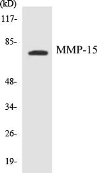 MMP-15 Colorimetric Cell-Based ELISA Kit (CBCAB00330)