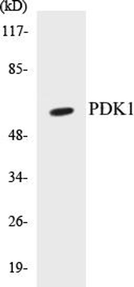 PDK1 Colorimetric Cell-Based ELISA Kit (CBCAB00348)