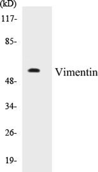 Vimentin Colorimetric Cell-Based ELISA Kit (CBCAB00372)