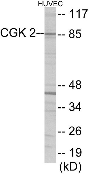 CGK 2 Colorimetric Cell-Based ELISA (CBCAB00384)