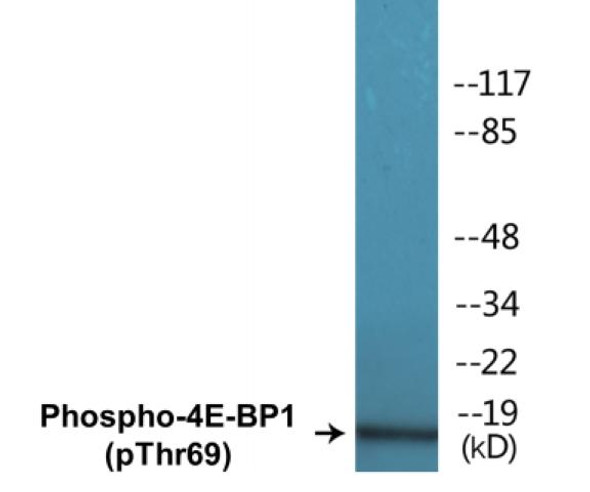 4E-BP1 (Phospho-Thr69)Colorimetric Cell-Based ELISA Kit (CBCAB00405)