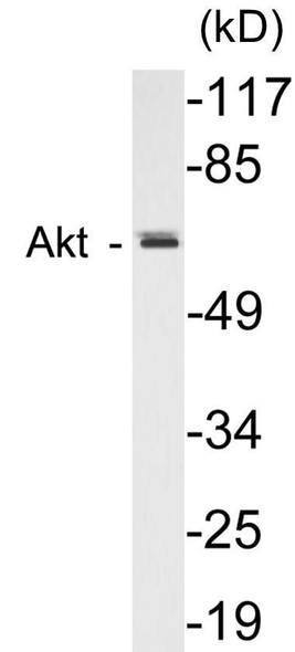 AIRE Colorimetric Cell-Based ELISA Kit (CBCAB00517)