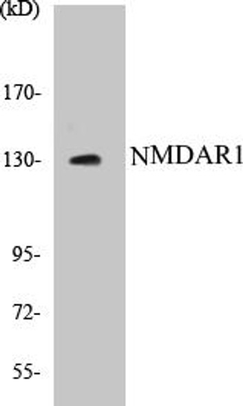 NMDAR1 Colorimetric Cell-Based ELISA Kit (CBCAB00782)