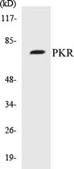 PKR Colorimetric Cell-Based ELISA Kit (CBCAB00823)