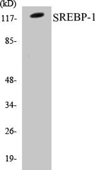 SREBP-1 Colorimetric Cell-Based ELISA Kit (CBCAB00864)