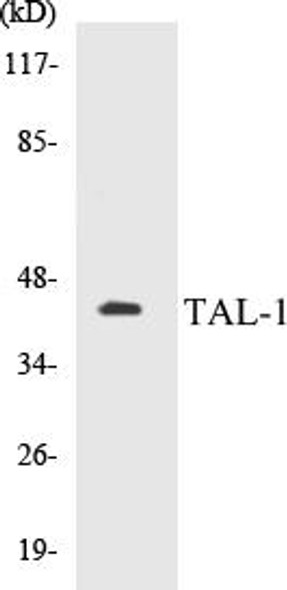 TAL-1 Colorimetric Cell-Based ELISA Kit (CBCAB00879)