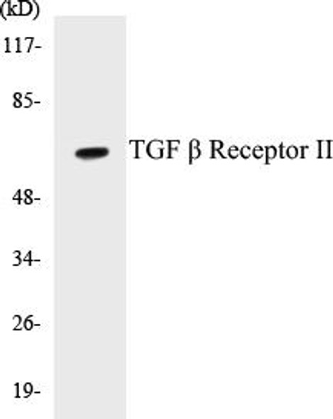 TGF beta Receptor II Colorimetric Cell-Based ELISA Kit (CBCAB00881) TGF beta Receptor II Colorimetric Cell-Based ELISA Kit (CBCAB00881)