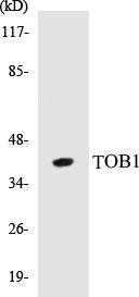 TOB1 Colorimetric Cell-Based ELISA Kit (CBCAB00889)