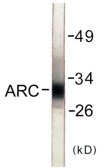 ARC Colorimetric Cell-Based ELISA (CBCAB00911)
