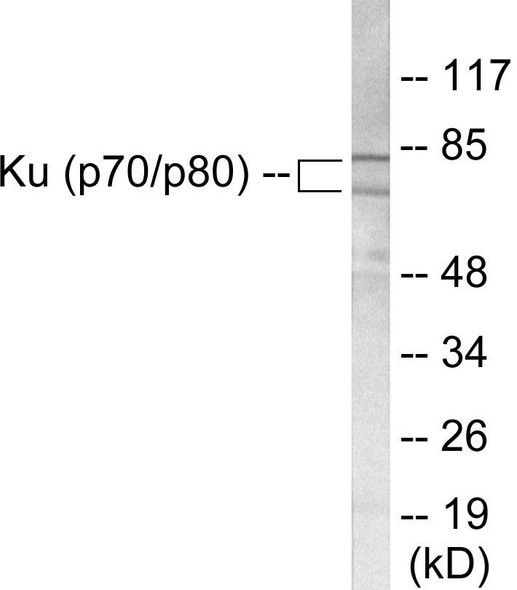 Ku70/80 Colorimetric Cell-Based ELISA (CBCAB00915)