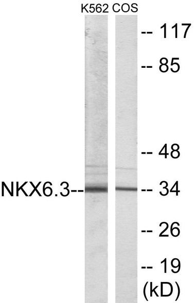 NKX6.3 Colorimetric Cell-Based ELISA (CBCAB00918)
